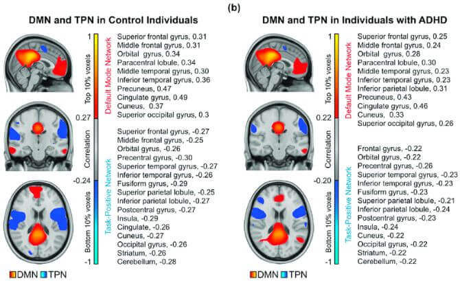 Areas of the brain involved with the Default Mode Network and Task-Positive Networks.