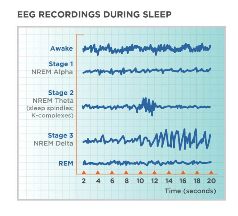 the four stages of sleep and their effect on brainwaves